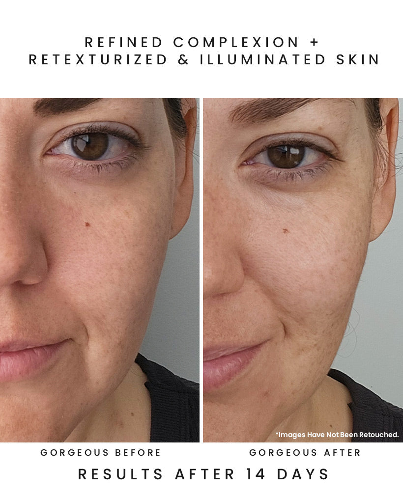 LUNA RAIN 15-Acid Resurfacing Serum
